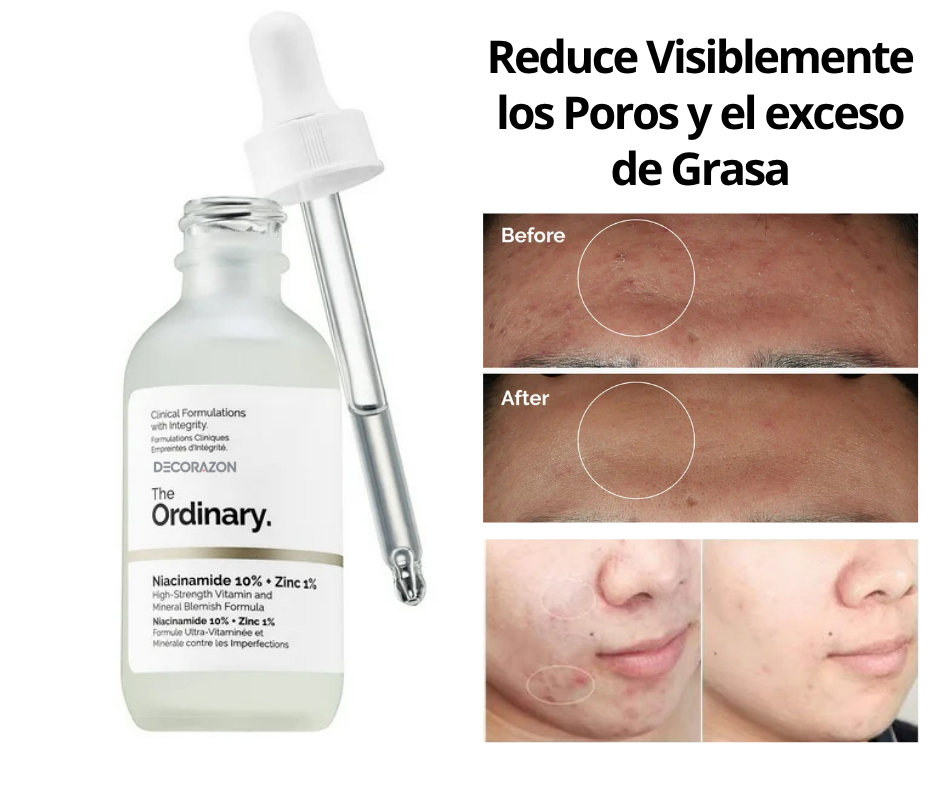 The Ordinary - Duo Niacinamida 10%, Zinc 1% y Ácido Hialurónico
