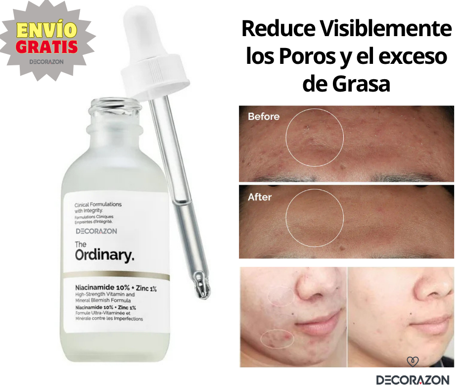 The Ordinary - Niacinamida 10% + Zinc 1%