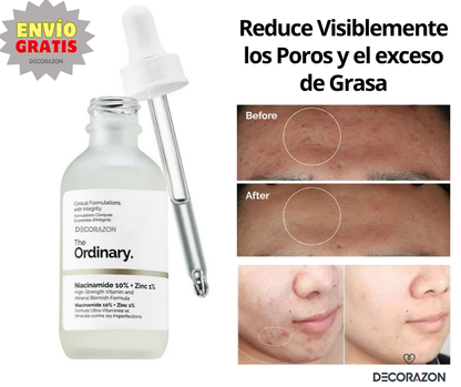 The Ordinary - Niacinamida 10% + Zinc 1%